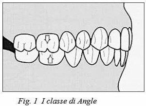 1bclasseAngle